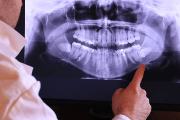 Best Walk-In Emergency Dentist in Lexington, MI