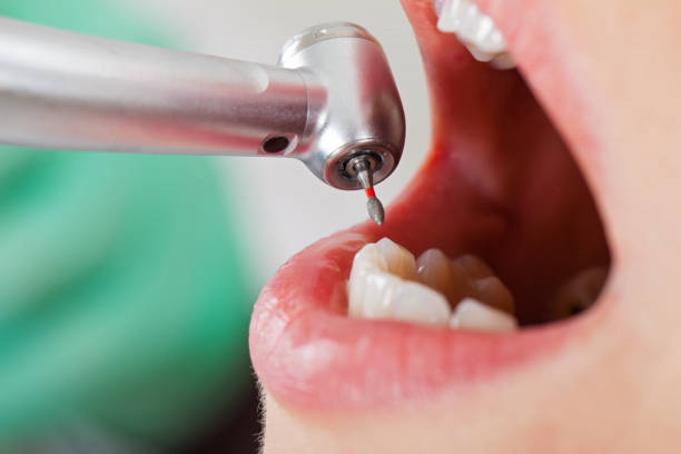 Best Emergency Broken Tooth Repair in Lexington, MI